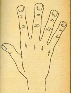 The Spatulate Hand
