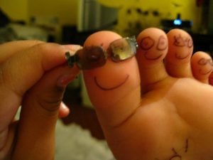 bigtoe