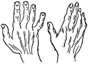 spatulatehand