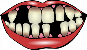 losing teeth